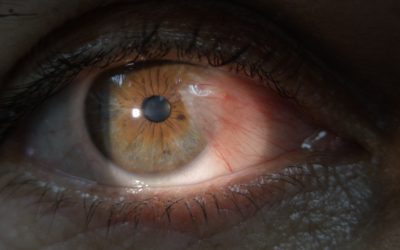 ¿Qué es la diabetes y cómo afecta tus ojos?