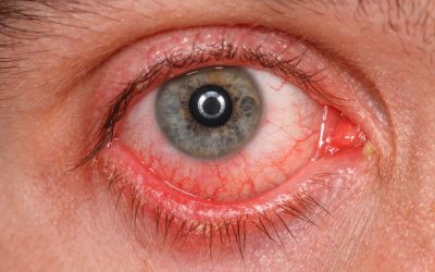 Enfermedades más comunes de los ojos