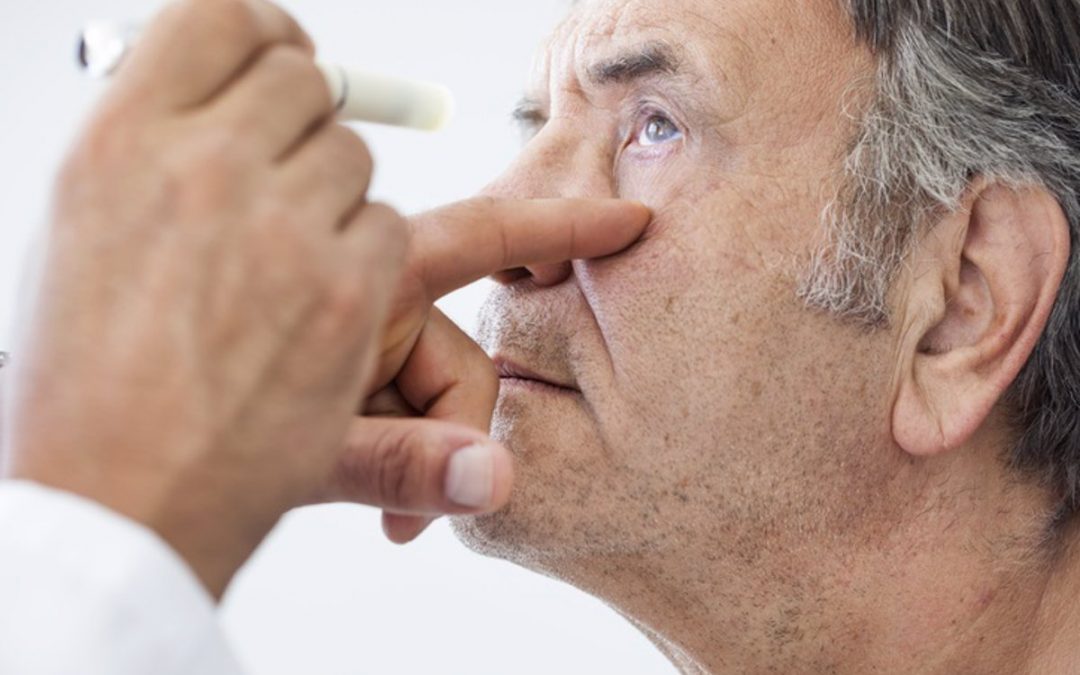 ¿Existe el cáncer en los ojos?